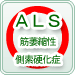 筋萎縮性側索硬化症(ALS)